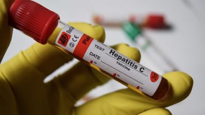 Роспотребнадзор разработал новый метод диагностики гепатита С