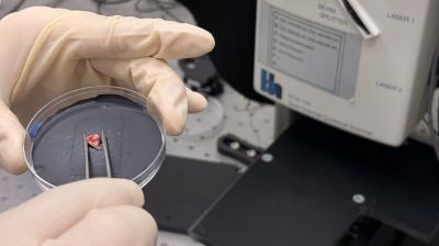 Российские ученые предложили высокоточный метод диагностики опухолей головного мозга 