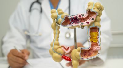Обновлены рекомендации по медикаментозному лечению болезни Крона средней и тяжелой степеней