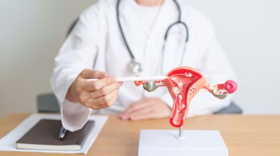 Эндометриоз не ухудшал течение воспалительных заболеваний кишечника