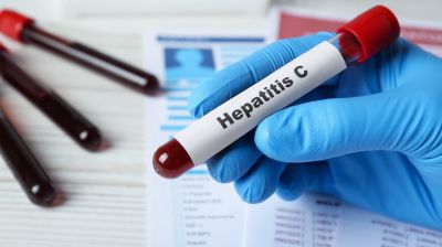 Обновлены клинические рекомендации по лечению гепатита С