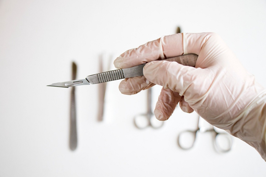 Следователи в Сочи ищут оставившего скальпель в теле пациентки хирурга