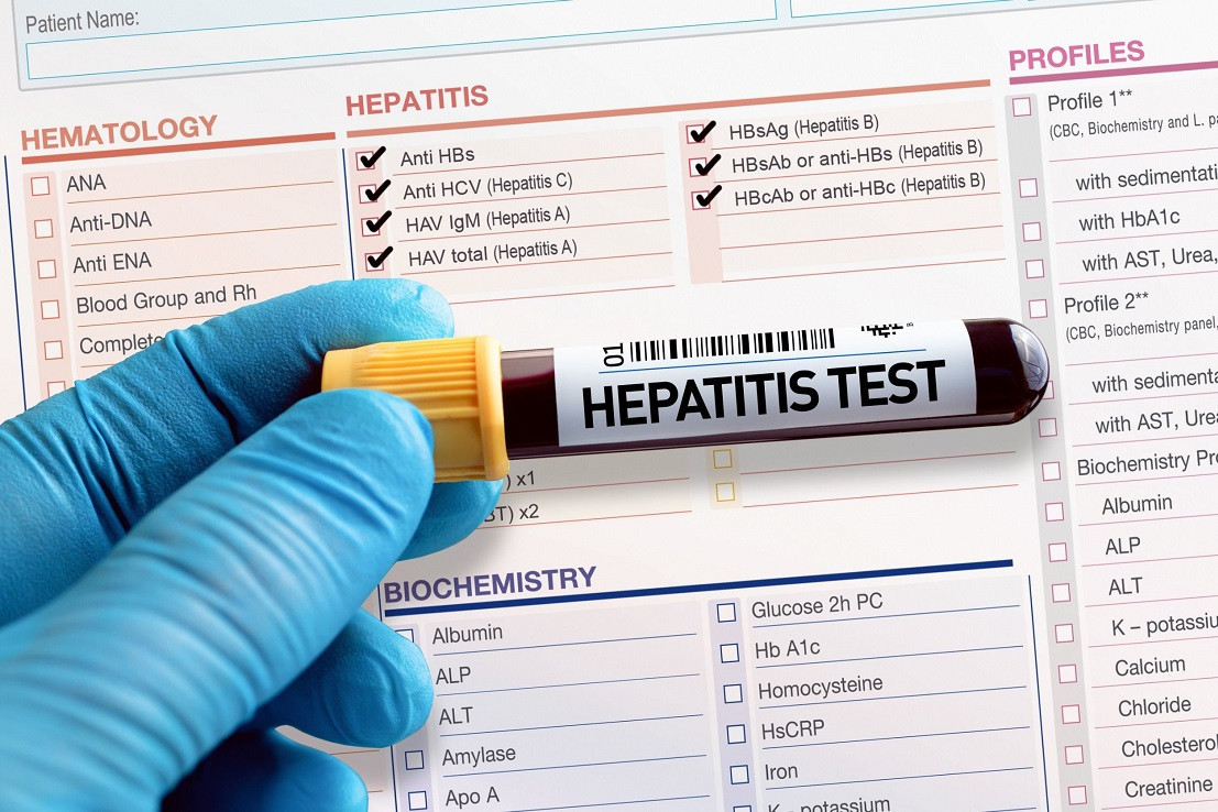 Doctor hcv. Тест на гепатит с. Булевиртид. Blood Test Hepatitis b. Гепатит c.