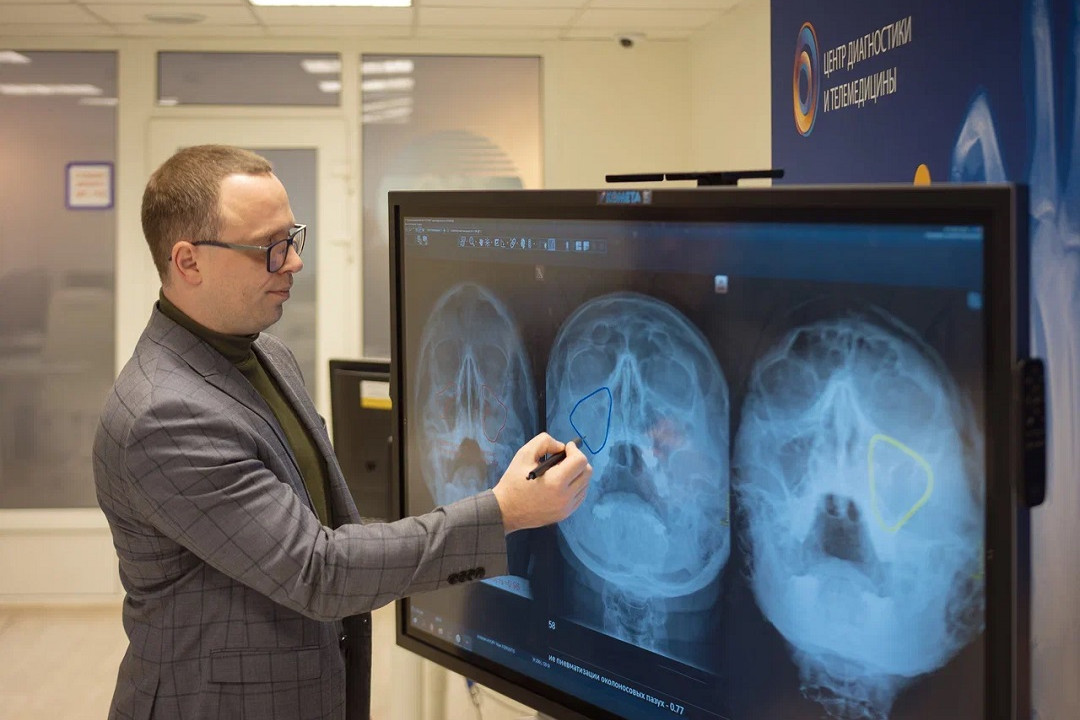 В Москве нейросети научили распознавать синусит на рентгене носовых пазух