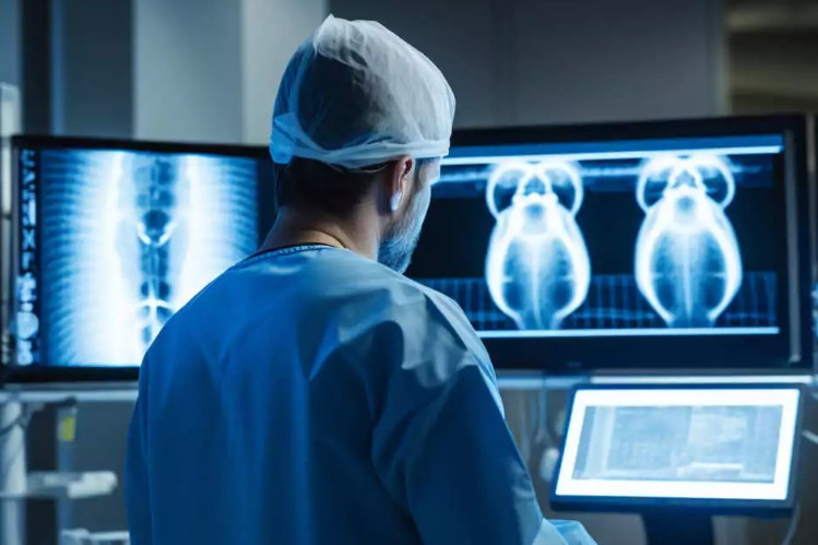 Мировой рынок ИИ в медицинской визуализации будет расти со среднегодовым темпом свыше 33%