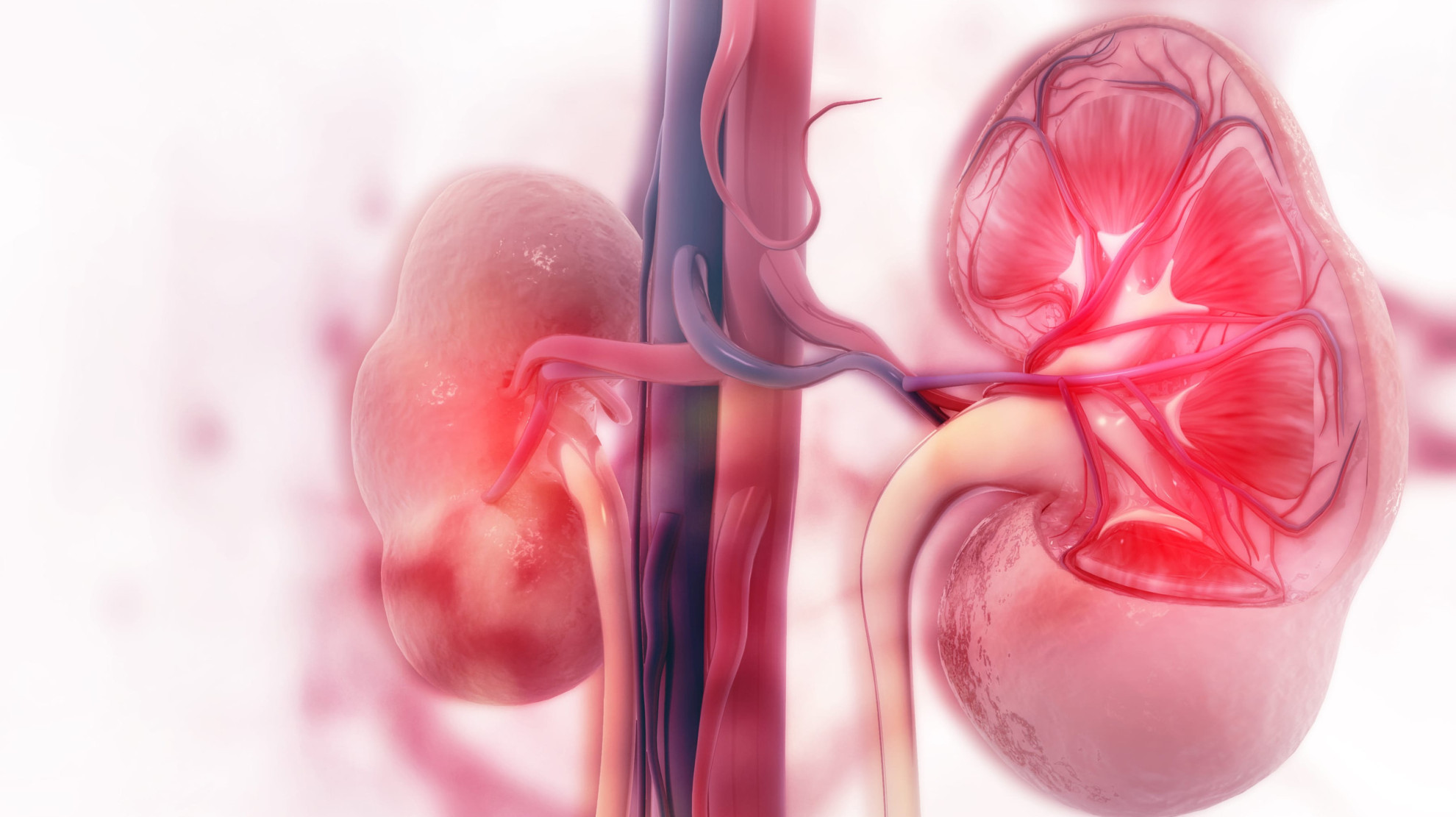 Комбинация belzutifan и пембролизумаба улучшила выживаемость при раке почки