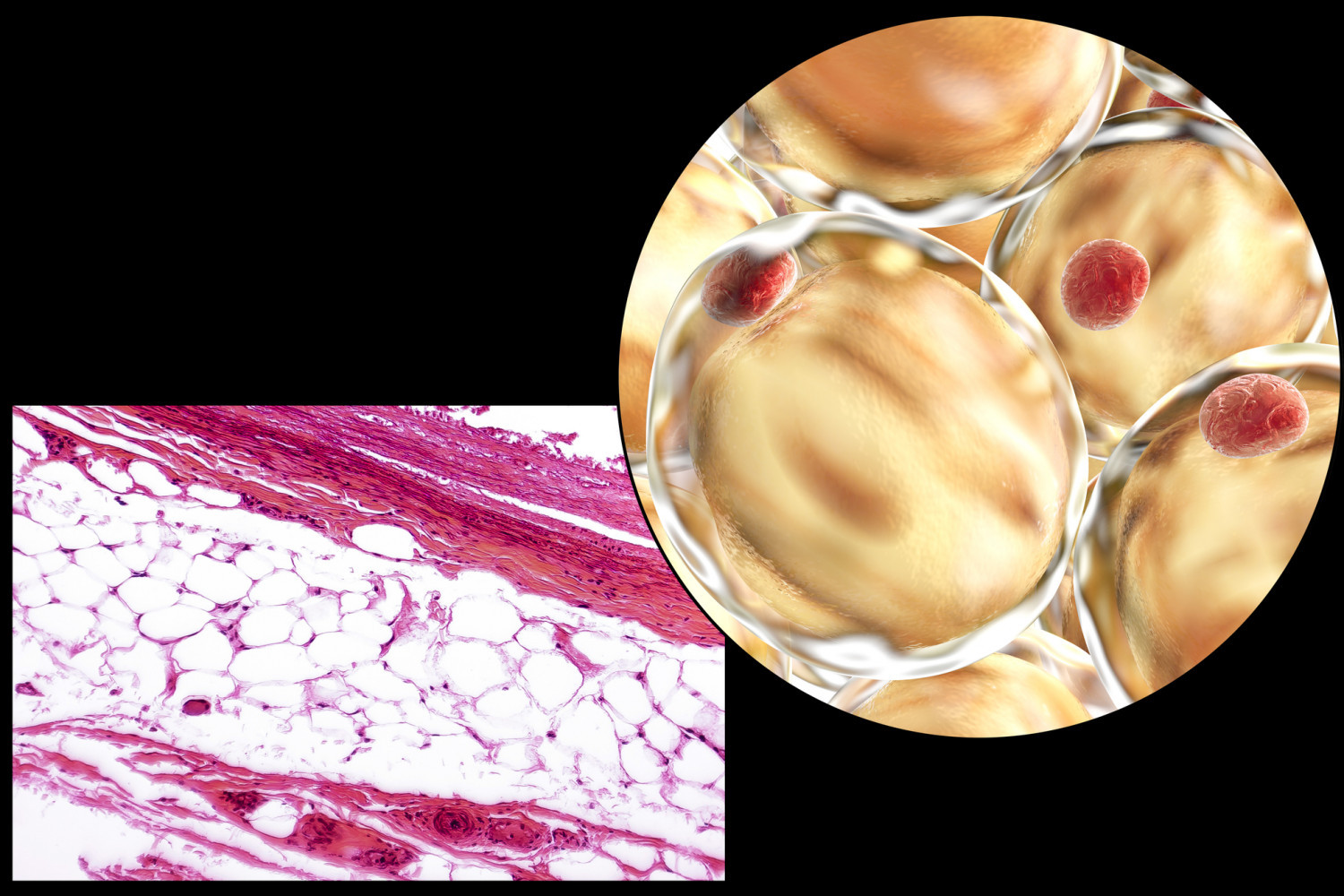 Жировая ткань человека фото