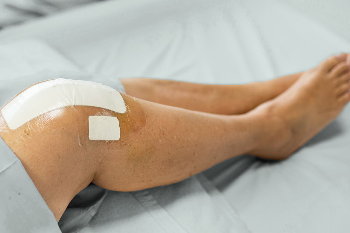 Пластырь на колено после операции