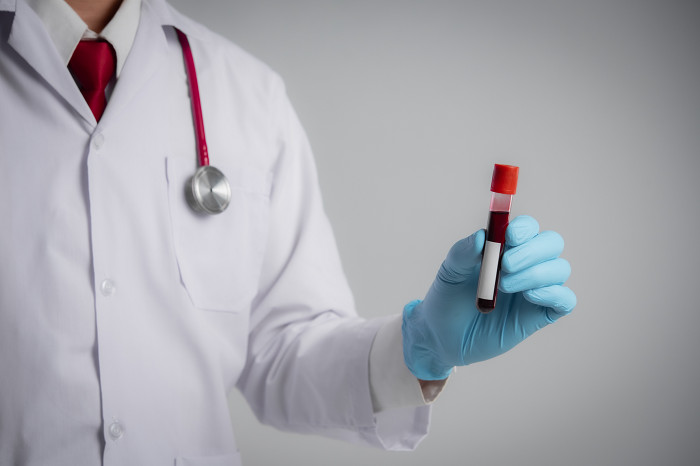 Истинная полицитемия: как заподозрить и не пропустить » Медвестник