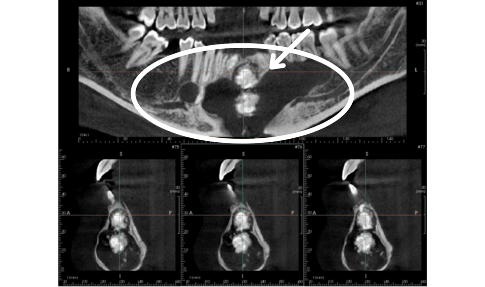 article_river_0d3e81c0638011f1917d49c20f3e2f9a-5.png (381 KB)